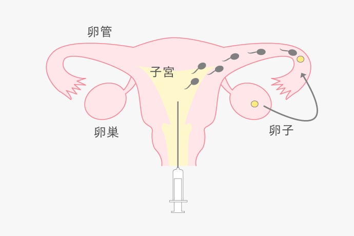 膣内に射出された精子が受精するまでの図